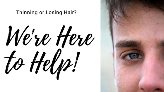 We're here to help with your hair loss